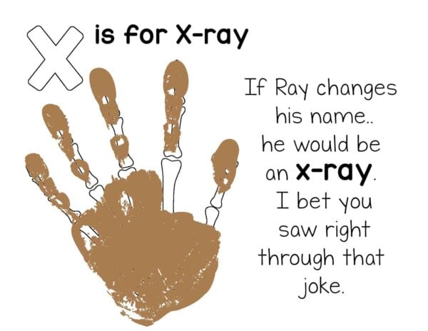 Free X-Ray Handprint Art Printable